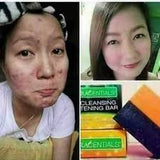 Deep Cleansing and Whitening Bar